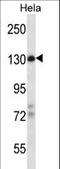 Zinc Finger And BTB Domain Containing 11 antibody, LS-C160719, Lifespan Biosciences, Western Blot image 