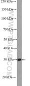 Methylmalonic aciduria and homocystinuria type D homolog, mitochondrial antibody, 23191-1-AP, Proteintech Group, Western Blot image 