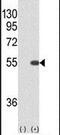 Serine/Threonine Kinase 40 antibody, PA5-26629, Invitrogen Antibodies, Western Blot image 