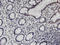 Polycomb Group Ring Finger 3 antibody, LS-C134023, Lifespan Biosciences, Immunohistochemistry paraffin image 