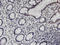 Polycomb group RING finger protein 3 antibody, LS-C134023, Lifespan Biosciences, Immunohistochemistry paraffin image 