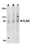 Toll Like Receptor 5 antibody, orb108987, Biorbyt, Western Blot image 