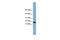 Ankyrin Repeat Domain 37 antibody, GTX45188, GeneTex, Western Blot image 