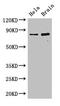 Inhibitor of growth protein 3 antibody, CSB-PA865171LA01HU, Cusabio, Western Blot image 