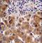 Psoriasis Susceptibility 1 Candidate 1 antibody, LS-C162255, Lifespan Biosciences, Immunohistochemistry frozen image 