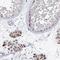 Coiled-Coil Domain Containing 73 antibody, NBP1-90689, Novus Biologicals, Immunohistochemistry frozen image 