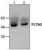 Tectonic-2 antibody, TA318894, Origene, Western Blot image 