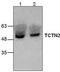 Tectonic-2 antibody, TA318894, Origene, Western Blot image 