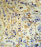Fibrinogen Alpha Chain antibody, A00816, Boster Biological Technology, Immunohistochemistry paraffin image 