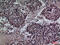 Surfactant Protein A2 antibody, GTX34193, GeneTex, Immunohistochemistry paraffin image 