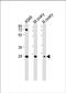 Insulin Like Growth Factor Binding Protein 4 antibody, PA5-72502, Invitrogen Antibodies, Western Blot image 