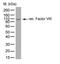 Coagulation Factor VIII antibody, GTX41190, GeneTex, Western Blot image 