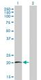 Surfactant Protein C antibody, H00006440-B01P, Novus Biologicals, Western Blot image 