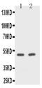 CD2 Molecule antibody, GTX12099, GeneTex, Western Blot image 