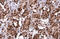 Protein Arginine Methyltransferase 1 antibody, GTX630186, GeneTex, Immunohistochemistry paraffin image 