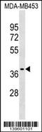 Purinergic Receptor P2X 3 antibody, 60-165, ProSci, Western Blot image 