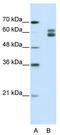 MutS Homolog 2 antibody, TA346017, Origene, Western Blot image 