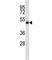 Suppressor of cytokine signaling 4 antibody, F43941-0.4ML, NSJ Bioreagents, Western Blot image 