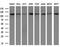 Poly(ADP-Ribose) Glycohydrolase antibody, MA5-27034, Invitrogen Antibodies, Western Blot image 