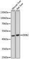 Damage Specific DNA Binding Protein 2 antibody, GTX54039, GeneTex, Western Blot image 