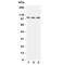 Tight Junction Protein 3 antibody, R31078, NSJ Bioreagents, Western Blot image 