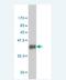 Chimerin 1 antibody, H00001123-M01, Novus Biologicals, Western Blot image 