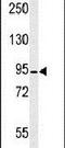 Calpain 3 antibody, PA5-26818, Invitrogen Antibodies, Western Blot image 