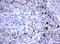 TNKS antibody, LS-C175678, Lifespan Biosciences, Immunohistochemistry paraffin image 