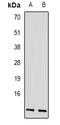 Adaptor Related Protein Complex 3 Subunit Beta 1 antibody, LS-C482746, Lifespan Biosciences, Western Blot image 