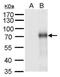 Interleukin 17 Receptor B antibody, NBP2-43767, Novus Biologicals, Western Blot image 