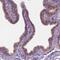 Galactose Mutarotase antibody, NBP2-38252, Novus Biologicals, Immunohistochemistry frozen image 