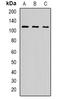 USO1 Vesicle Transport Factor antibody, orb382113, Biorbyt, Western Blot image 