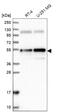 Ankyrin Repeat Domain 10 antibody, NBP2-37891, Novus Biologicals, Western Blot image 