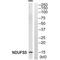 NADH:Ubiquinone Oxidoreductase Subunit S5 antibody, A04093, Boster Biological Technology, Western Blot image 