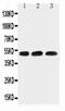 Hyaluronidase 1 antibody, PA2181-1, Boster Biological Technology, Western Blot image 
