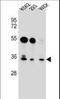 GLIPR1 Like 2 antibody, LS-C166502, Lifespan Biosciences, Western Blot image 