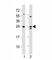 Lin-28 Homolog A antibody, F53240-0.4ML, NSJ Bioreagents, Western Blot image 