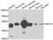 Amylase Alpha 1C (Salivary) antibody, A6867, ABclonal Technology, Western Blot image 