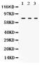 Transglutaminase 2 antibody, PB9448, Boster Biological Technology, Western Blot image 