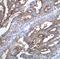 Mucin 16, Cell Surface Associated antibody, M01641-1, Boster Biological Technology, Immunohistochemistry frozen image 