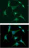 S100 Calcium Binding Protein A4 antibody, GTX57640, GeneTex, Immunocytochemistry image 