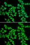 Hydroxyacyl-CoA Dehydrogenase Trifunctional Multienzyme Complex Subunit Beta antibody, GTX54152, GeneTex, Immunocytochemistry image 