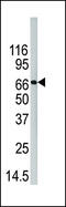 Peptidyl Arginine Deiminase 4 antibody, 61-423, ProSci, Western Blot image 