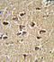 BicC Family RNA Binding Protein 1 antibody, 62-564, ProSci, Immunohistochemistry paraffin image 