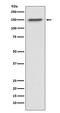 Tumor Protein P53 Binding Protein 2 antibody, M02609, Boster Biological Technology, Western Blot image 