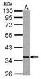 Rab Geranylgeranyltransferase Subunit Beta antibody, PA5-28324, Invitrogen Antibodies, Western Blot image 