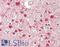 Actinin Alpha 1 antibody, LS-B13855, Lifespan Biosciences, Immunohistochemistry paraffin image 