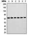 RAR Related Orphan Receptor A antibody, orb315688, Biorbyt, Western Blot image 