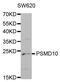 Proteasome 26S Subunit, Non-ATPase 10 antibody, MBS127030, MyBioSource, Western Blot image 