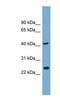 Tetratricopeptide Repeat Domain 23 Like antibody, NBP1-57634, Novus Biologicals, Western Blot image 